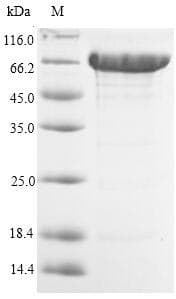 Human ACSS1 Protein (Recombinant 10His, N-terminus)