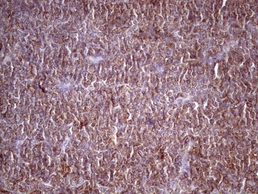 Monoclonal Mouse anti-Human HAVCR2 / TIM-3 Antibody (clone OTI2E2, aa22-202, IHC)