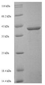 Human SIGLEC15 Protein (Recombinant 6His-SUMO, N-terminus)