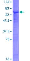 Human SKP2 Protein (Recombinant GST)