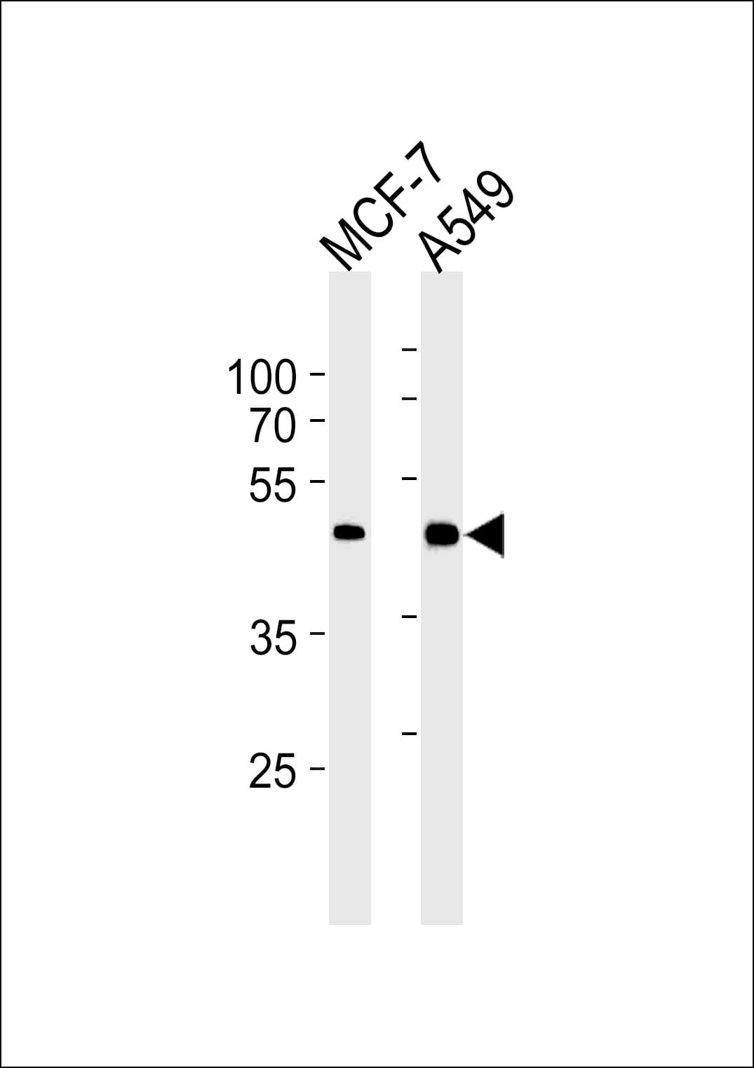 CDK20 / CCRK Antibody (clone 885CT27.1.1)
