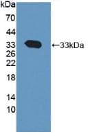 Rat CAPN1 / Calpain 1 Protein (Recombinant His, N-Terminal)