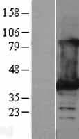 LDHB / Lactate Dehydrogenase B Protein (Over-Expression Lysate Myc-DDK (Flag))