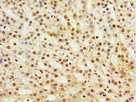 TAF1C Antibody (aa70-320)