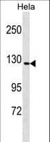 GTF3 / GTF2IRD1 Antibody (aa79-108)