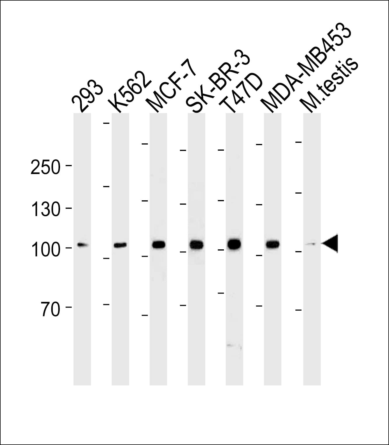 Monoclonal Mouse anti-Human ACE2 / ACE-2 Antibody (clone 881CT16.4.4, WB)