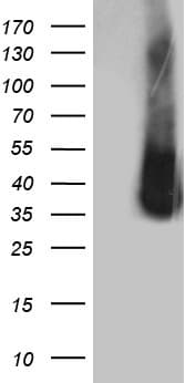 Monoclonal Mouse anti-Human ZCCHC17 / PNO40 / PS1D Antibody (clone OTI1F11, WB)