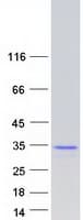 Human PID1 Protein (Recombinant Myc-DDK (Flag))