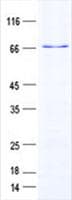 Human ZRP-1 / TRIP6 Protein (Recombinant GST, N-terminus + His, C-terminus)