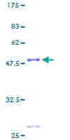 Human MRPL22 Protein (Recombinant GST)