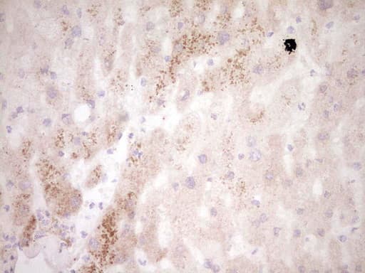 MMP7 / Matrilysin Antibody (aa95-267, clone OTI3E9)