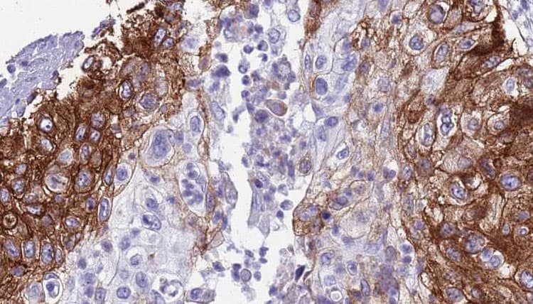 Polyclonal Rabbit anti-Human IL6R / IL6 Receptor Antibody (IHC, WB)