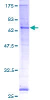 Human PORCN Protein (Recombinant GST)