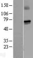 GUCY1A1 / GUCY1A3 Protein (Over-Expression Lysate Myc-DDK (Flag))