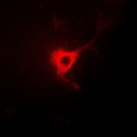 Polyclonal Rabbit anti-Human CDC25B Antibody (IHC, IF, WB)