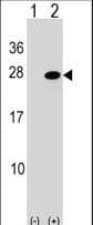 IHC-plus™ ATF3 Antibody (aa140-168)
