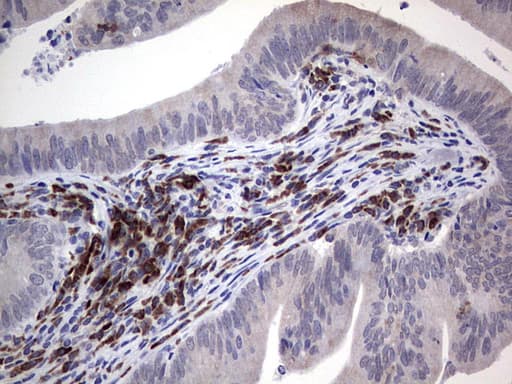 PDGFRA / PDGFR Alpha Antibody (aa32-324, clone 2E9)