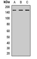 Polyclonal Rabbit anti-Human SPT5 / SUPT5H Antibody (WB)
