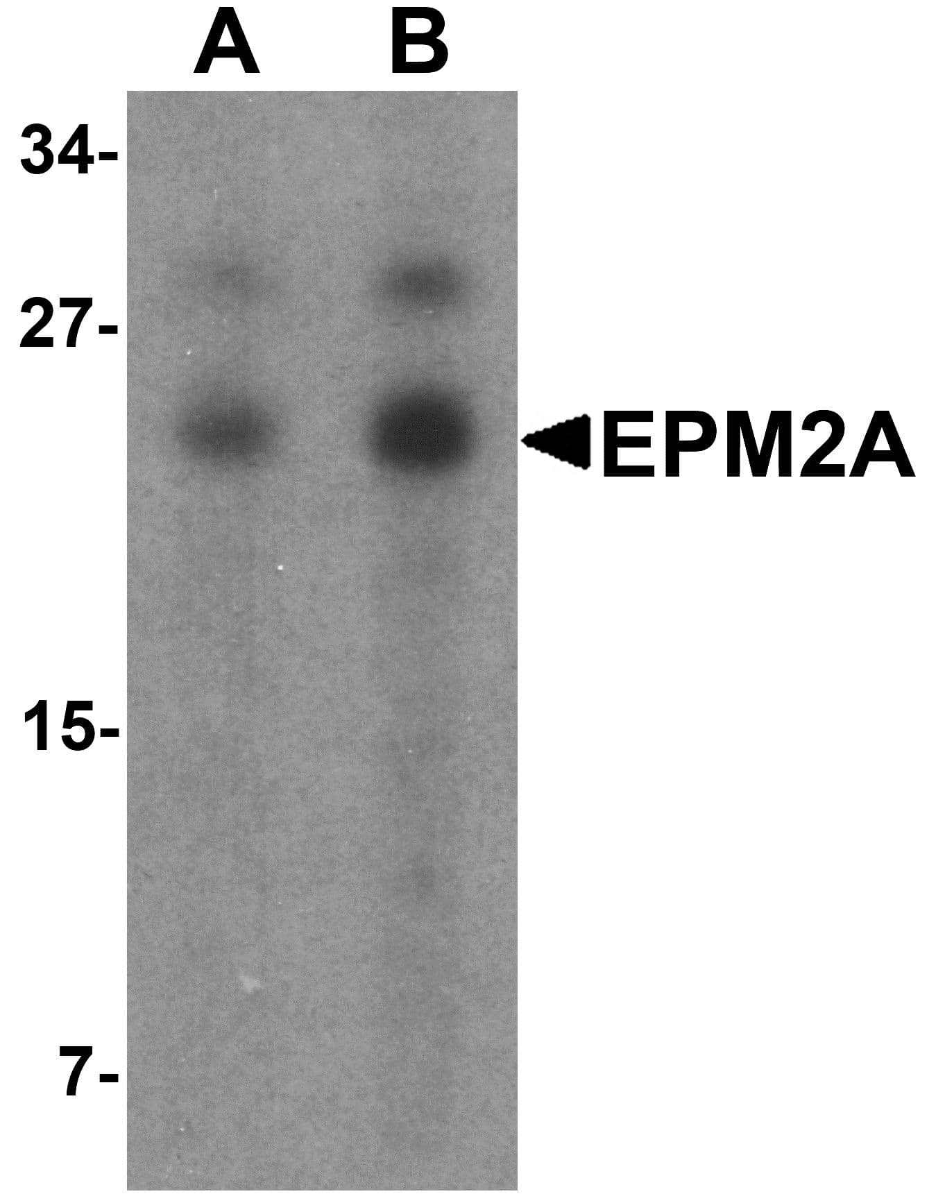 IHC-plus™ Polyclonal Rabbit anti-Human EPM2A / Laforin Antibody (IHC, IF, WB)