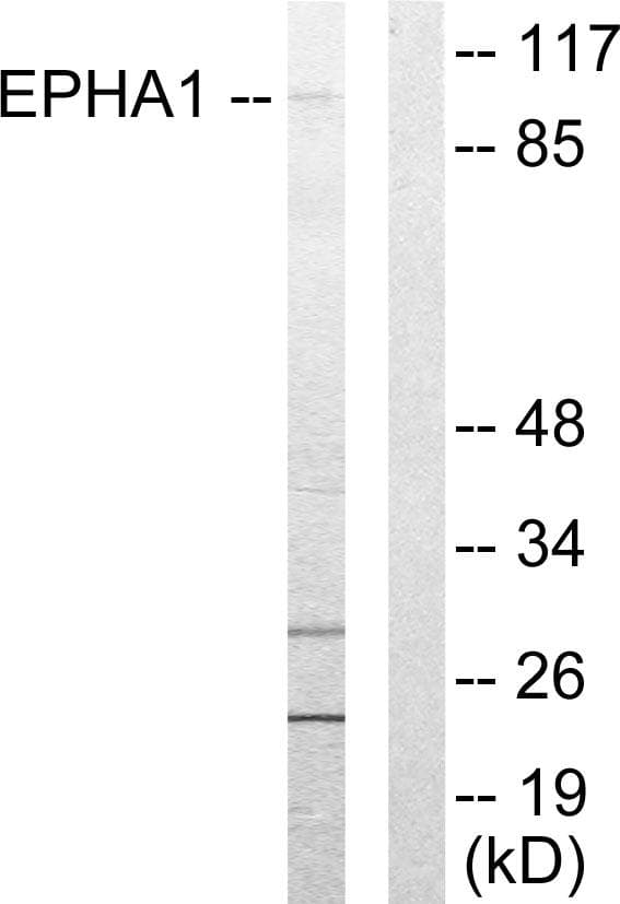 EPHA1 / EPH Receptor A1 Antibody