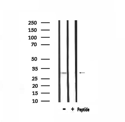 Polyclonal Rabbit anti-Human CNN2 Antibody (IF, WB)
