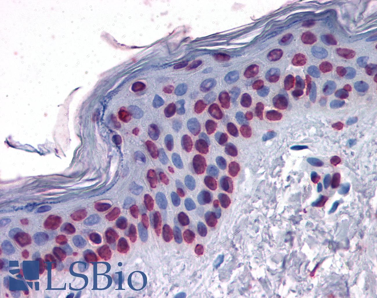 IHC-plus™ STAT3 Antibody (clone 7G3H4)