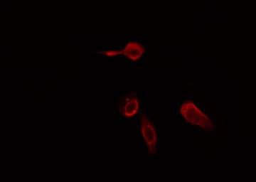 Polyclonal Rabbit anti-Human PLCB2 Antibody (IF, WB)