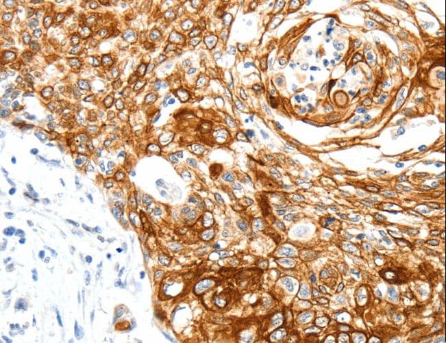 Polyclonal Rabbit anti-Human SIPA1 Antibody (IHC)