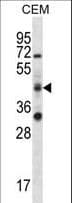 RBM42 Antibody (aa394-422)