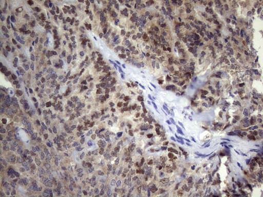 TP53 / p53 Antibody (clone OTIpab 240)