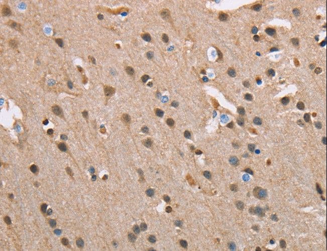 SERPINA1 / Alpha 1 Antitrypsin Antibody