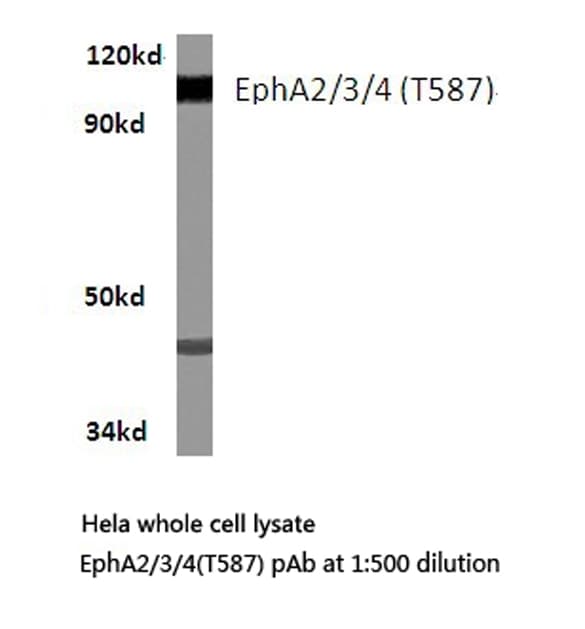 EPH Receptor A2+A3+A4 Antibody (Thr587/595)