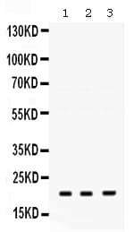 Polyclonal Rabbit anti-Human HRAS / H-Ras Antibody (WB)