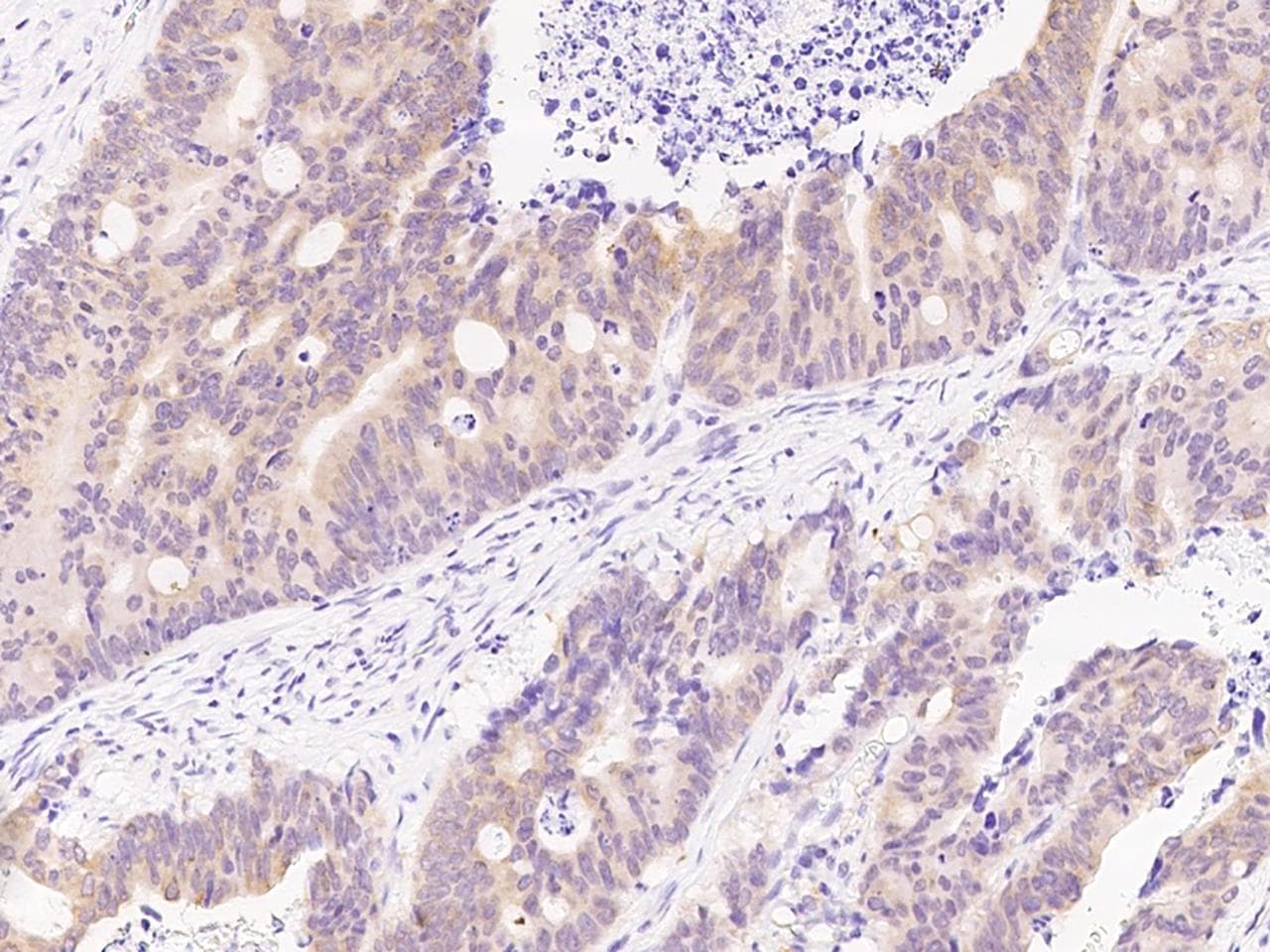 IGF2BP2 Antibody (Preservative Free)