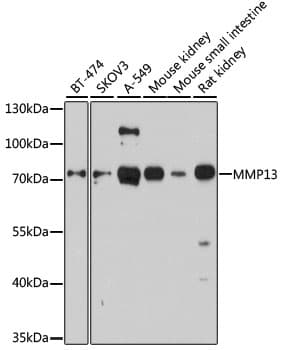 MMP13 Antibody