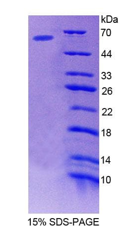 Human BACE1 / BACE Protein (Recombinant His-GST)