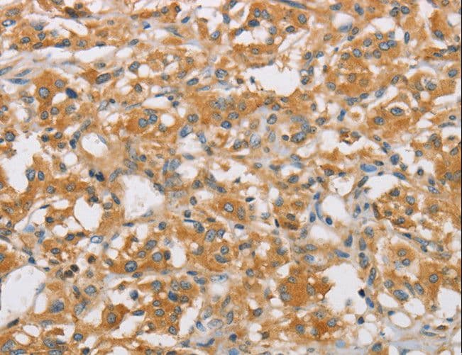 ARHGEF7 Antibody