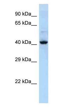 Polyclonal Rabbit anti-Human KRT36 / Keratin 36 / KRTHA6 Antibody (aa145-194, WB)
