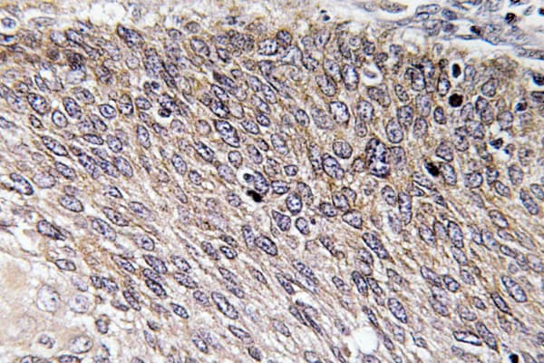 Polyclonal Rabbit anti-Human VASP Antibody (phospho-Ser238, IHC, WB)