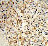 LPCAT1 / AYTL2 Antibody (aa506-534)