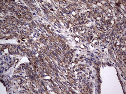 DOCK8 Antibody (aa832-1160, clone OTI4H10)
