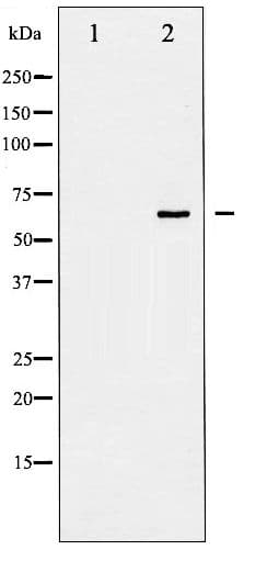 p66 / SHC Antibody (phospho-Tyr427)