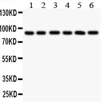 Polyclonal Rabbit anti-Human TLR1 Antibody (aa771-786, WB)