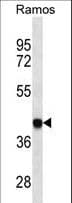 HLA-B Antibody (aa62-90)