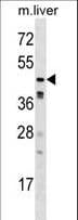 CAMK1G / CaMKI gamma Antibody (aa426-453)