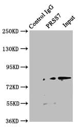 TMPRSS15 / Enterokinase Antibody