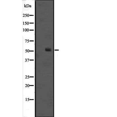 ONECUT1 / HNF6 Antibody