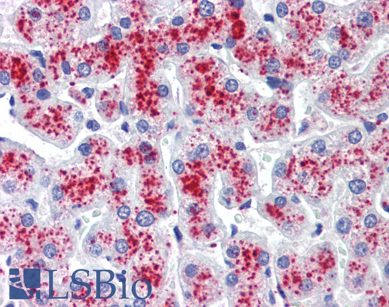 IHC-plus™ RNH1 Antibody (clone AT1H23)
