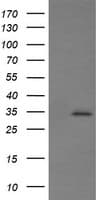 SYP / Synaptophysin Antibody (clone OTI1G3)