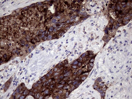 CD66c / CEACAM6 Antibody (aa35-257, clone OTI5A10)